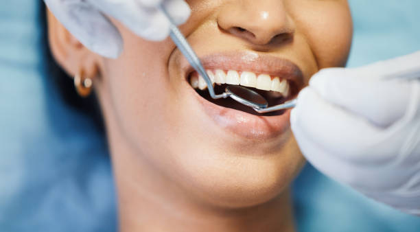 Best Emergency Wisdom Tooth Extraction in East Mckeesport, PA